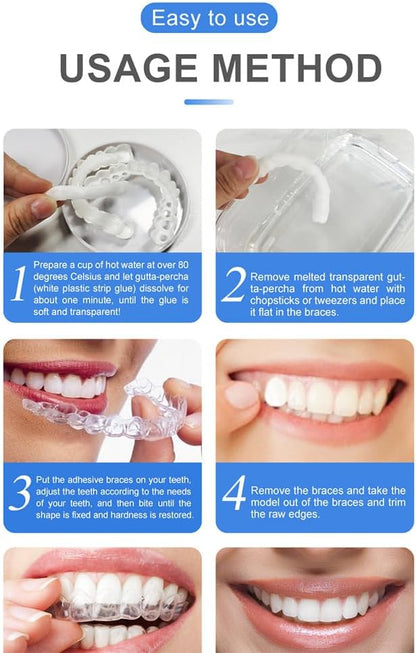 Snap On Smile Braces Teeth Kit For Men & Women