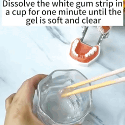 Snap On Smile Braces Teeth Kit For Men & Women